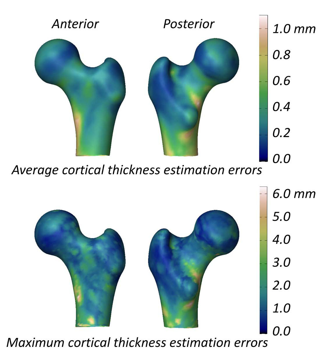 Color coded map of cortical thickness estimation errors of 3D-DXA.